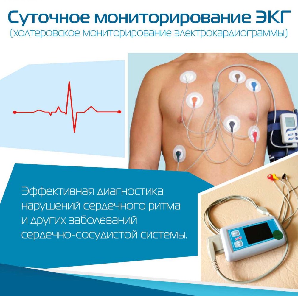 СМАД Холтер ЭКГ