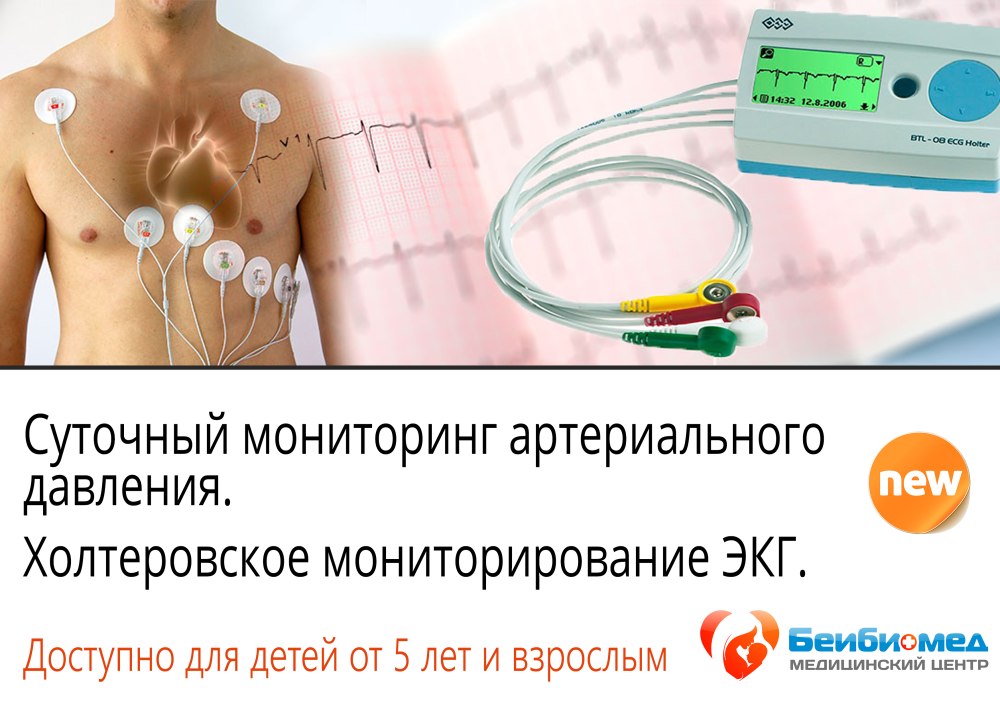 Суточное мониторирование ЭКГ (холтеровское мониторирование)